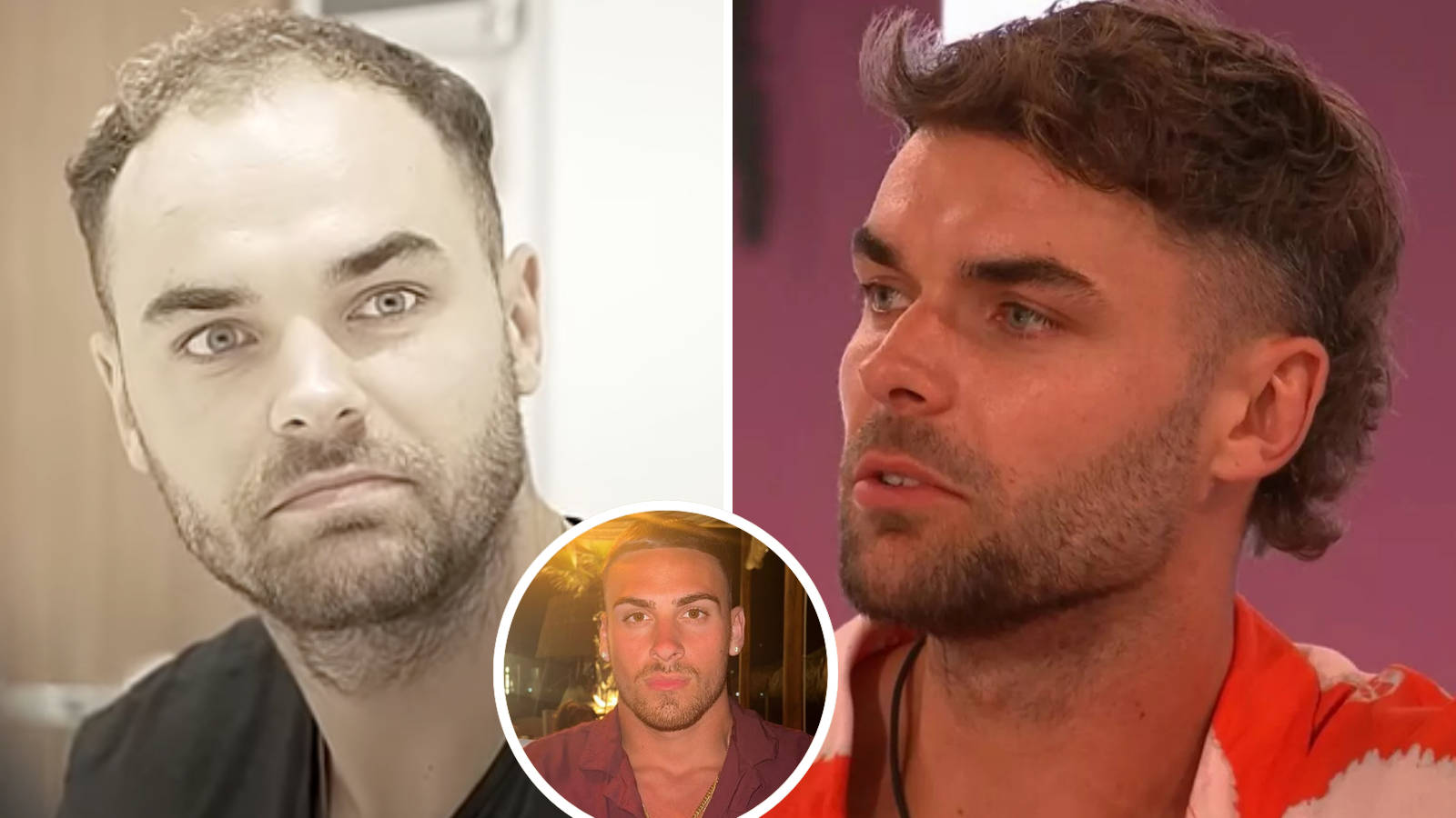 Transform Your Look with a Hair Transplant London Clinic You Can Trust