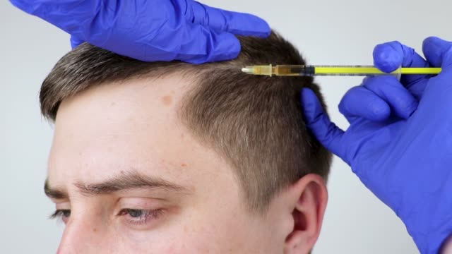 Hair Transplant Istanbul: Your 2025 Guide to Affordable Excellence