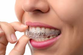 How Ceramic Braces Work to Straighten Your Smile